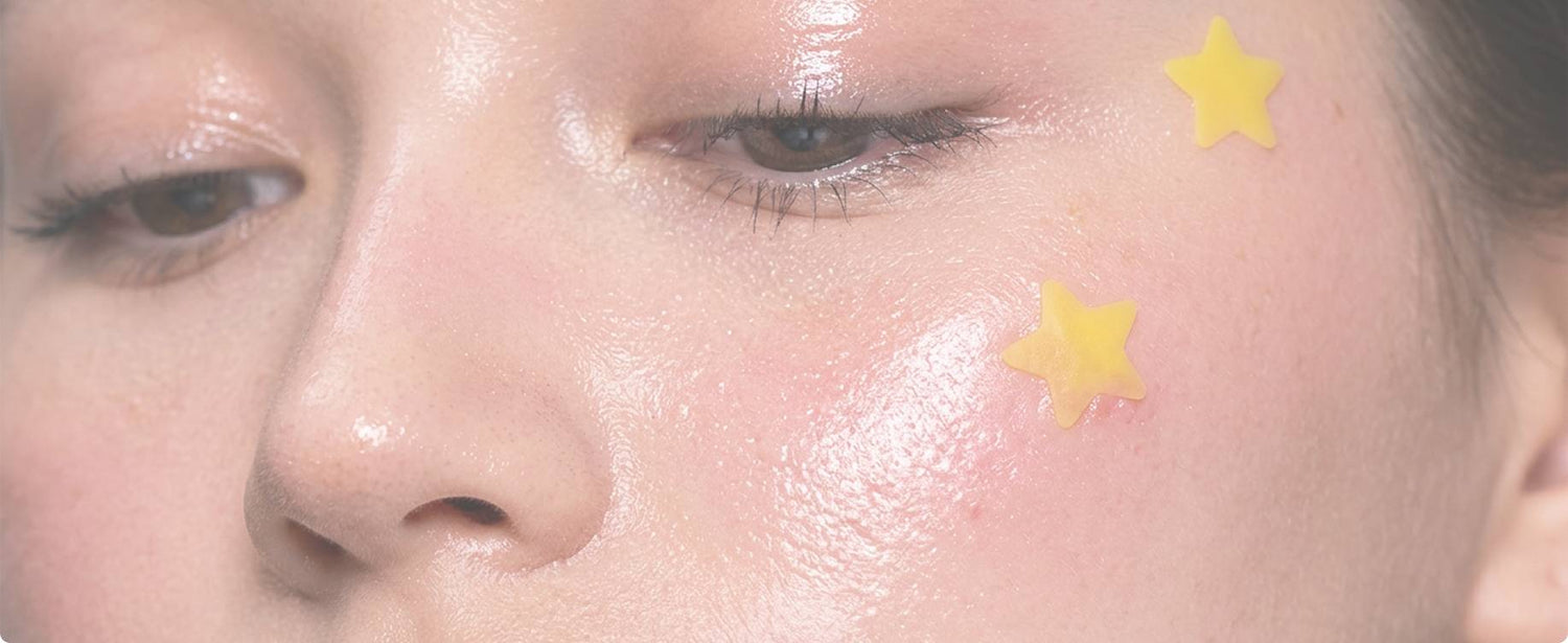 ACNE TREATMENTS