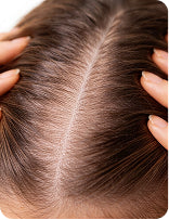 FINE HAIR