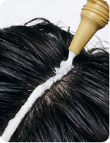 SCALP HEALTH