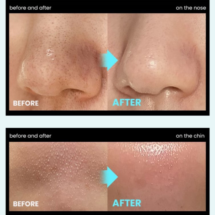Super Melting Sebum Softener - Embe Skin