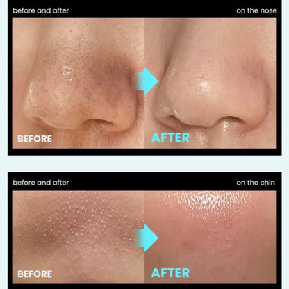Super Melting Sebum Softener - Embe Skin