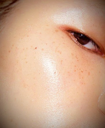PRECISION SKIN